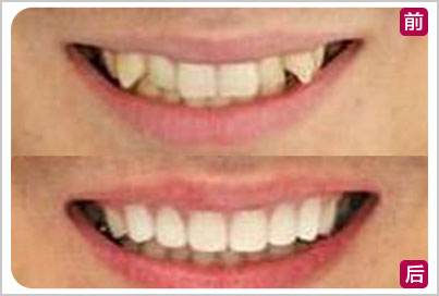 ݹ޸ǽ÷֮һ